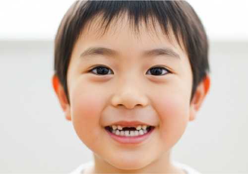 こどもの虫歯画像