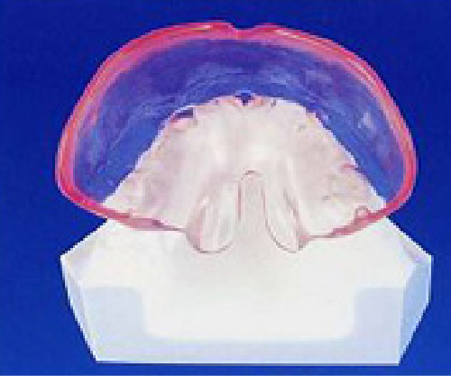 機能的矯正装置の画像2