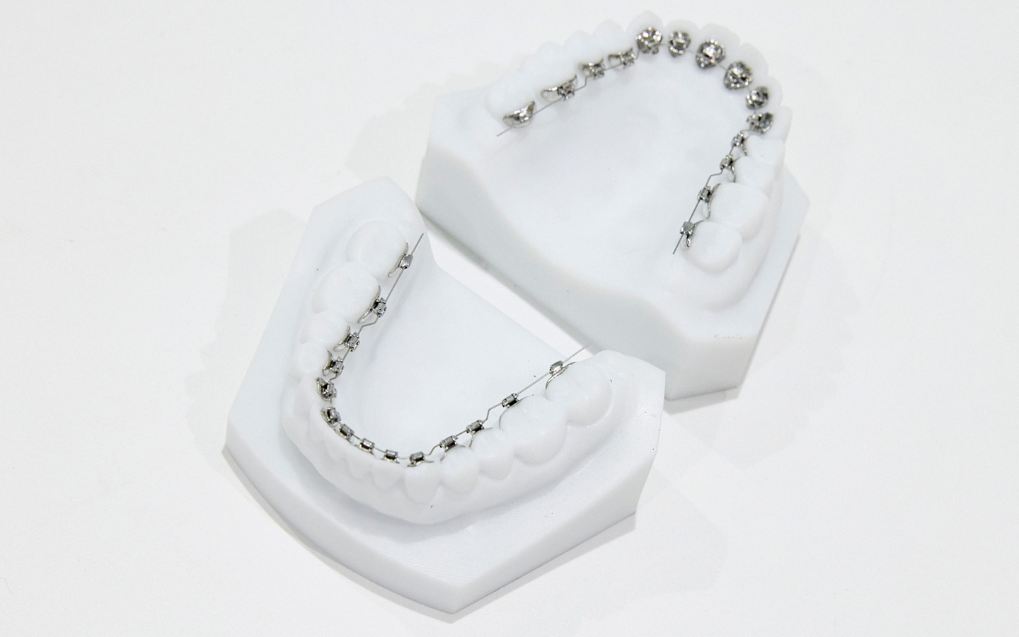 舌側矯正歯科装置